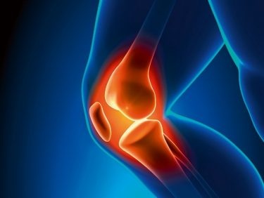 La douleur antérieure du genou, les raisons et solutions
