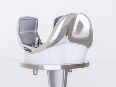 Neue Implantate und Methoden in der Knie- und Hüft-Endoprothetik – Was bringt wirklich Vorteile für den Patienten?