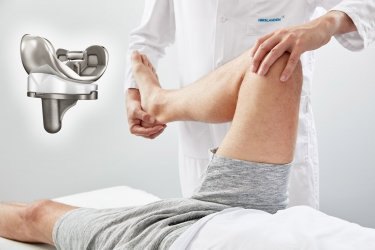 Moderne Knieprothesen mit Hilfe eines 3D-Druckers